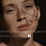 Cómo eliminar manchas en la piel
