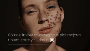 Cómo eliminar manchas en la piel
