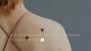 La Importancia de la Detección Temprana del Cáncer de Piel