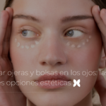 Eliminar ojeras y bolsas en los ojos: las mejores opciones estéticas