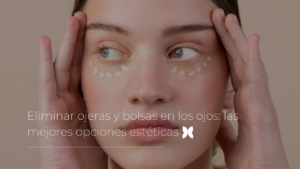 Eliminar ojeras y bolsas en los ojos: las mejores opciones estéticas