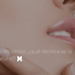 Relleno de labios: ¿qué técnica es la más natural?