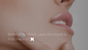 Relleno de labios: ¿qué técnica es la más natural?