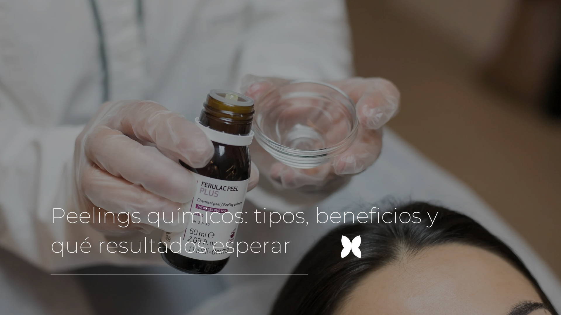 peelings químicos tipos beneficios y qué resultados esperar