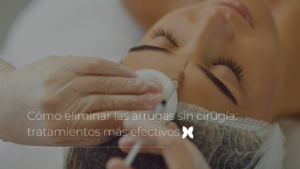 Cómo eliminar las arrugas sin cirugía tratamientos más efectivos