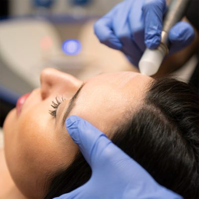 Tratamiento-Microdermoabrasion